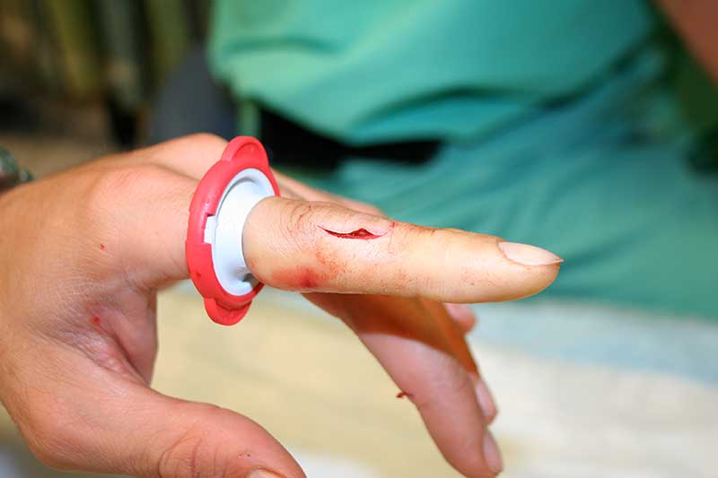 Bleeding controlled ok