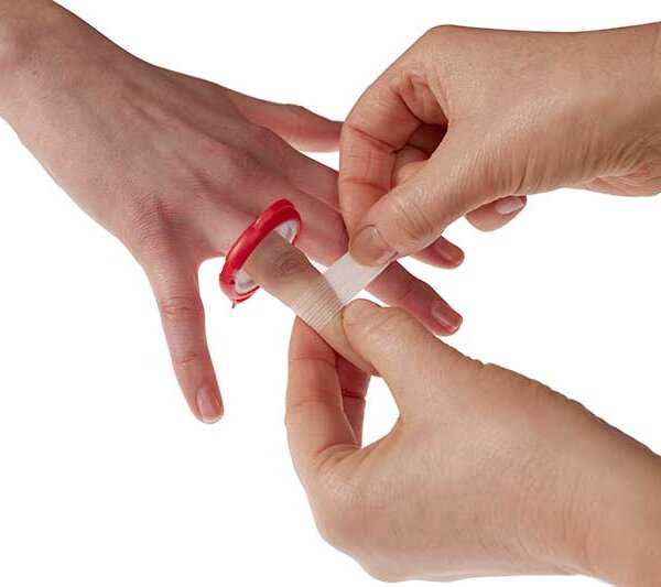 Wrap wound strip 1 ok